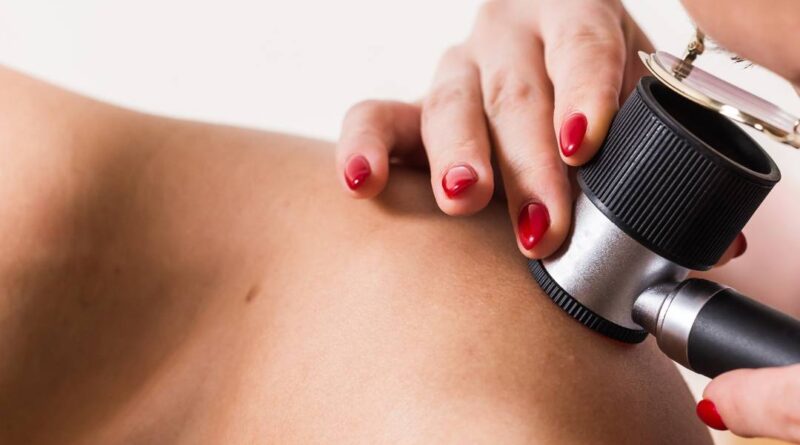 Como prevenir o câncer de pele